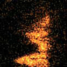 Triglycerides image of ion map of mouse leg: Duchenne Muscular Dystrophy Lipids
