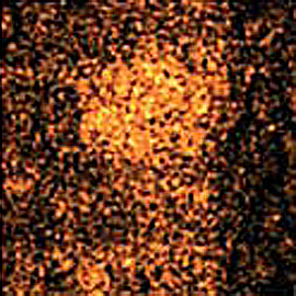 Vitamin E image of ion map of mouse leg: Duchenne Muscular Dystrophy Lipids
